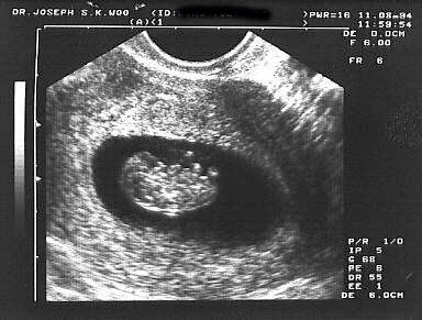 http://www.ob-ultrasound.net/images/cs8w.jpg