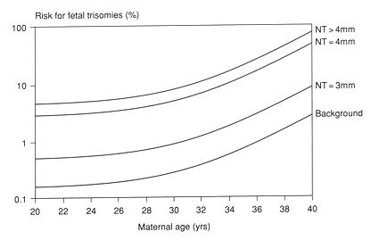 Odds Of Down Syndrome By Age Chart